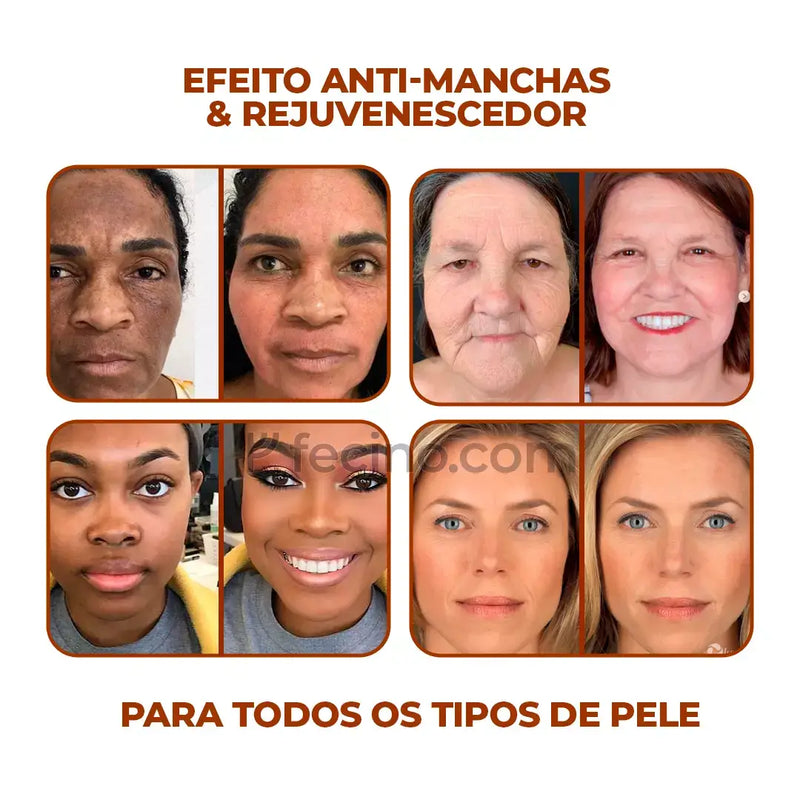 Focallure® - Corretivo 2 em 1 Efeito Anti-Manchas & Rejuvenescedor (LEVE 2 E ECONOMIZE)